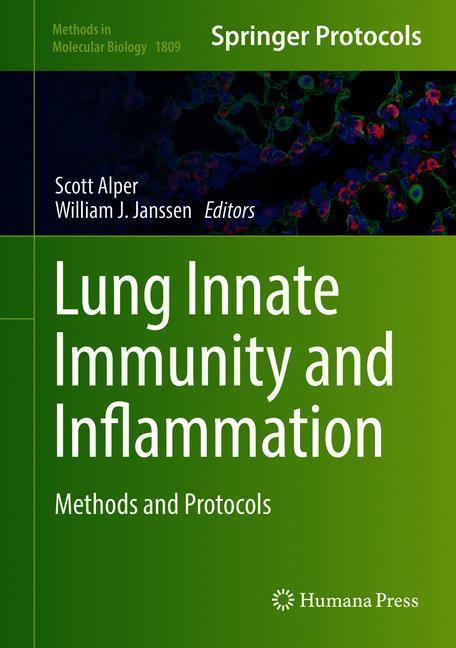 Lung Innate Immunity and Inflammation