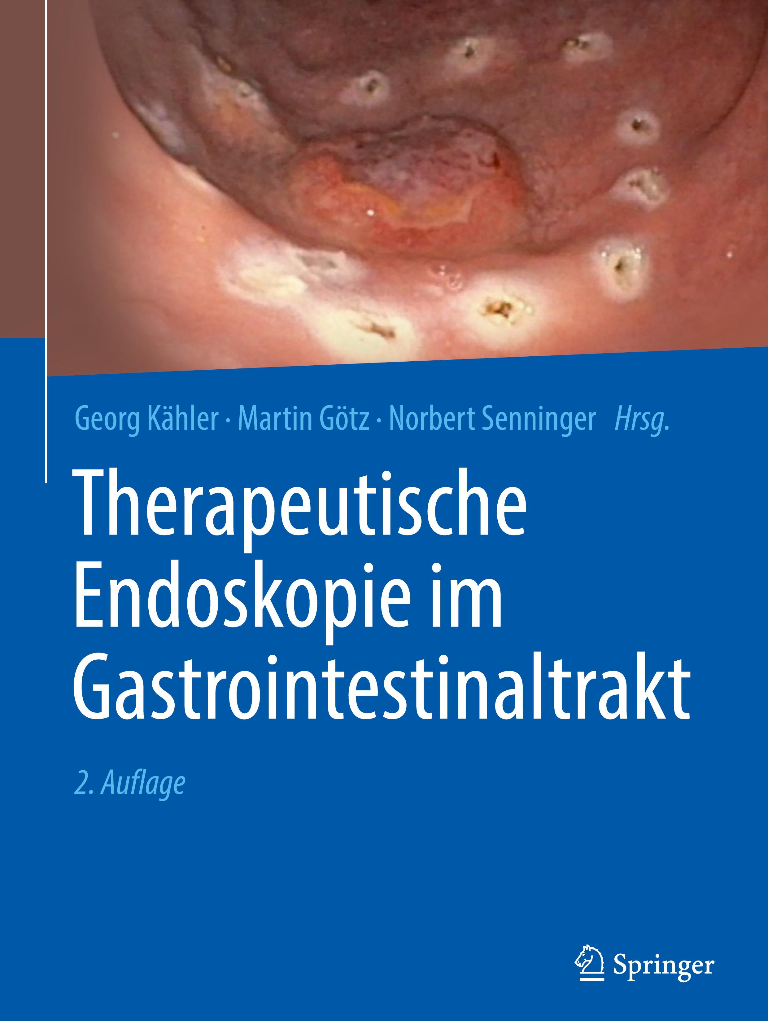 Therapeutische Endoskopie im Gastrointestinaltrakt