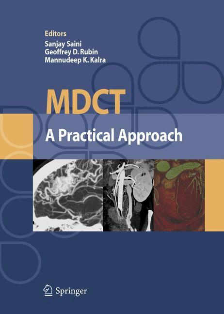 MDCT: A Practical Approach