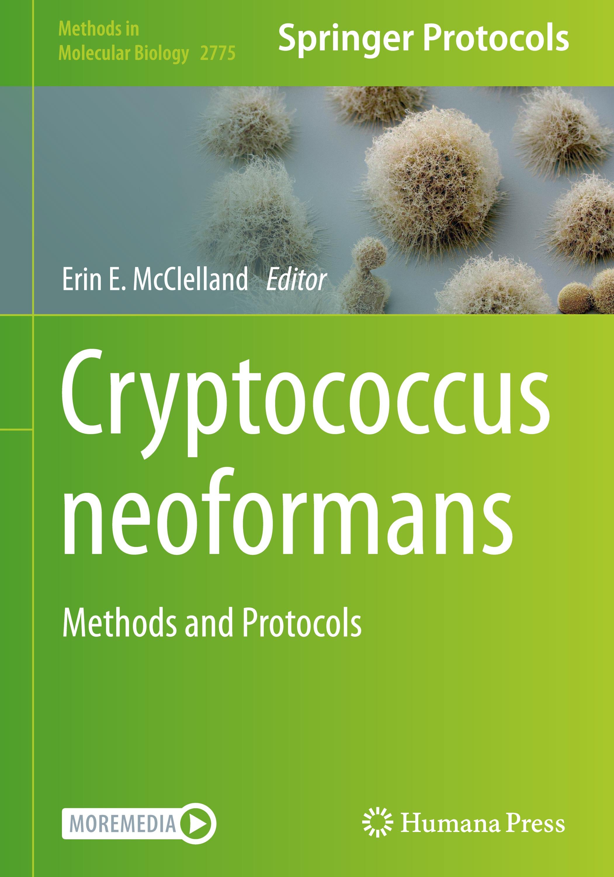 Cryptococcus neoformans