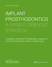 Implant Prosthodontics