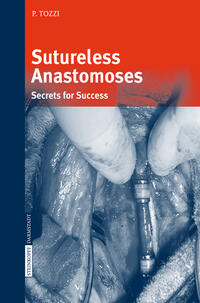 Sutureless Anastomoses