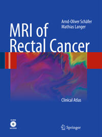 MRI of Rectal Cancer