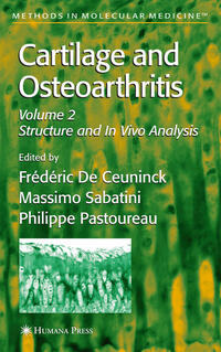 Cartilage and Osteoarthritis