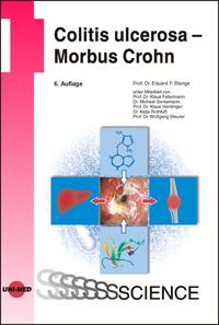 Colitis ulcerosa - Morbus Crohn