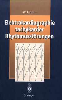 Elektrokardiographie tachykarder Rhythmusstörungen