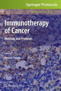 Immunotherapy of Cancer