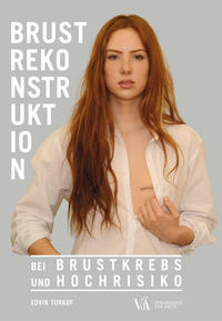 Brustrekonstruktion