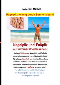 Nagelpilzheilung durch Sonnenlasern! Nagelpilz und Fußpilz auf nimmer Wiedersehen!