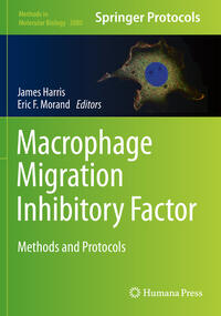 Macrophage Migration Inhibitory Factor