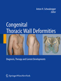 Congenital Thoracic Wall Deformities