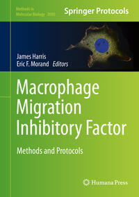 Macrophage Migration Inhibitory Factor