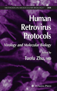 Human Retrovirus Protocols