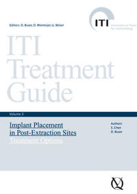 Implant Placement in Post-Extraction Sites