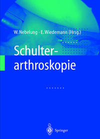 Schulterarthroskopie