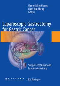 Laparoscopic Gastrectomy for Gastric Cancer