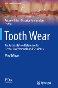 Tooth Wear