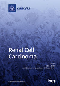 Renal Cell Carcinoma