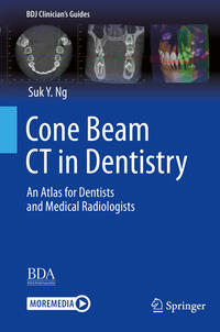 Cone Beam CT in Dentistry