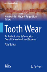 Tooth Wear