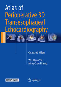 Atlas of Perioperative 3D Transesophageal Echocardiography