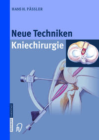 Neue Techniken Kniechirurgie