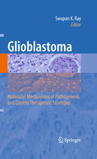 Glioblastoma: