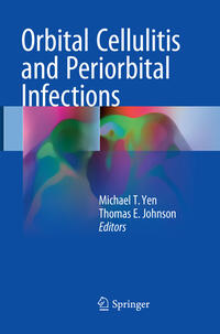 Orbital Cellulitis and Periorbital Infections