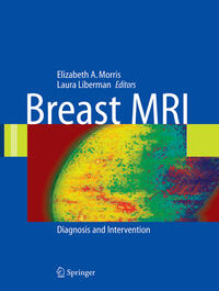 Breast MRI