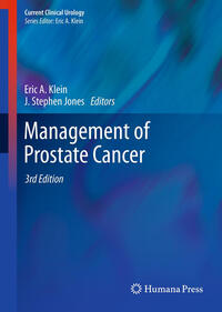 Management of Prostate Cancer