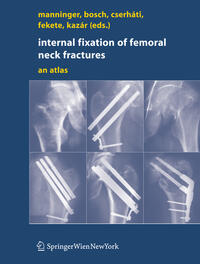 Internal fixation of femoral neck fractures