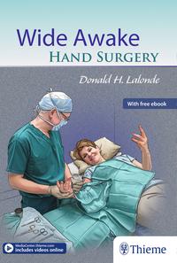 Wide Awake Hand Surgery