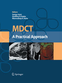 MDCT: A Practical Approach