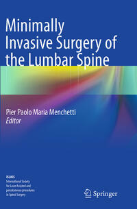 Minimally Invasive Surgery of the Lumbar Spine